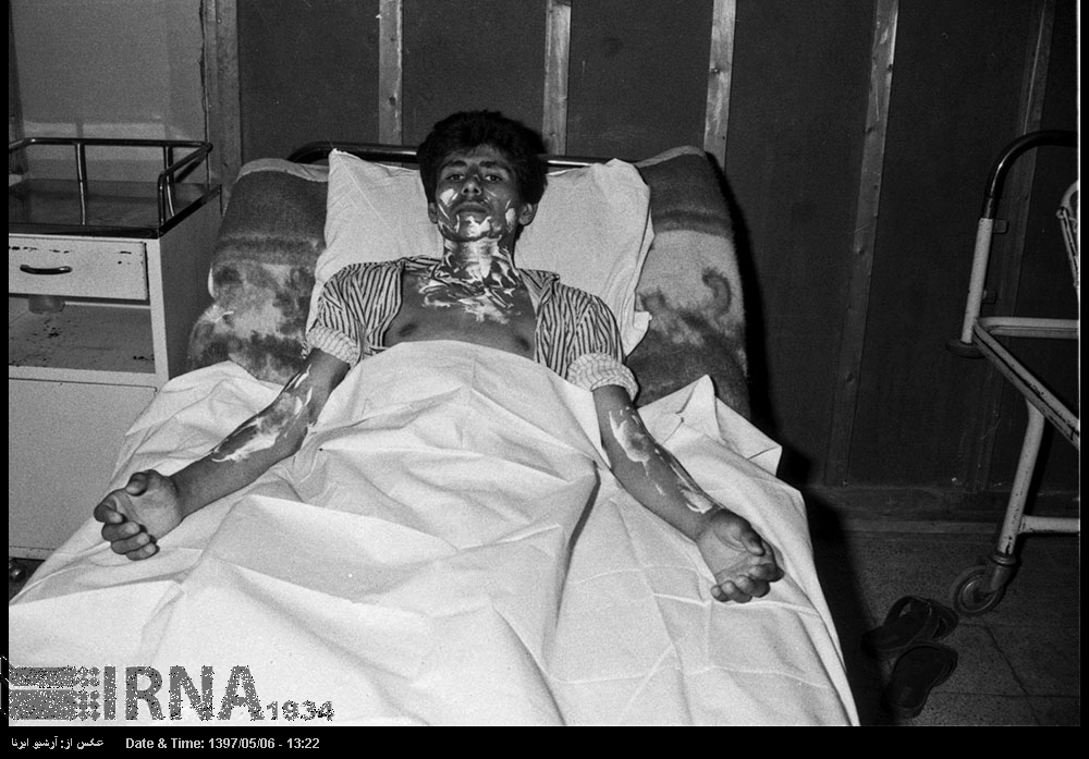 بمباران شیمیایی اشنویه را چرا از یاد بردید! بمباران شیمیایی اشنویه را چرا از یاد بردید!